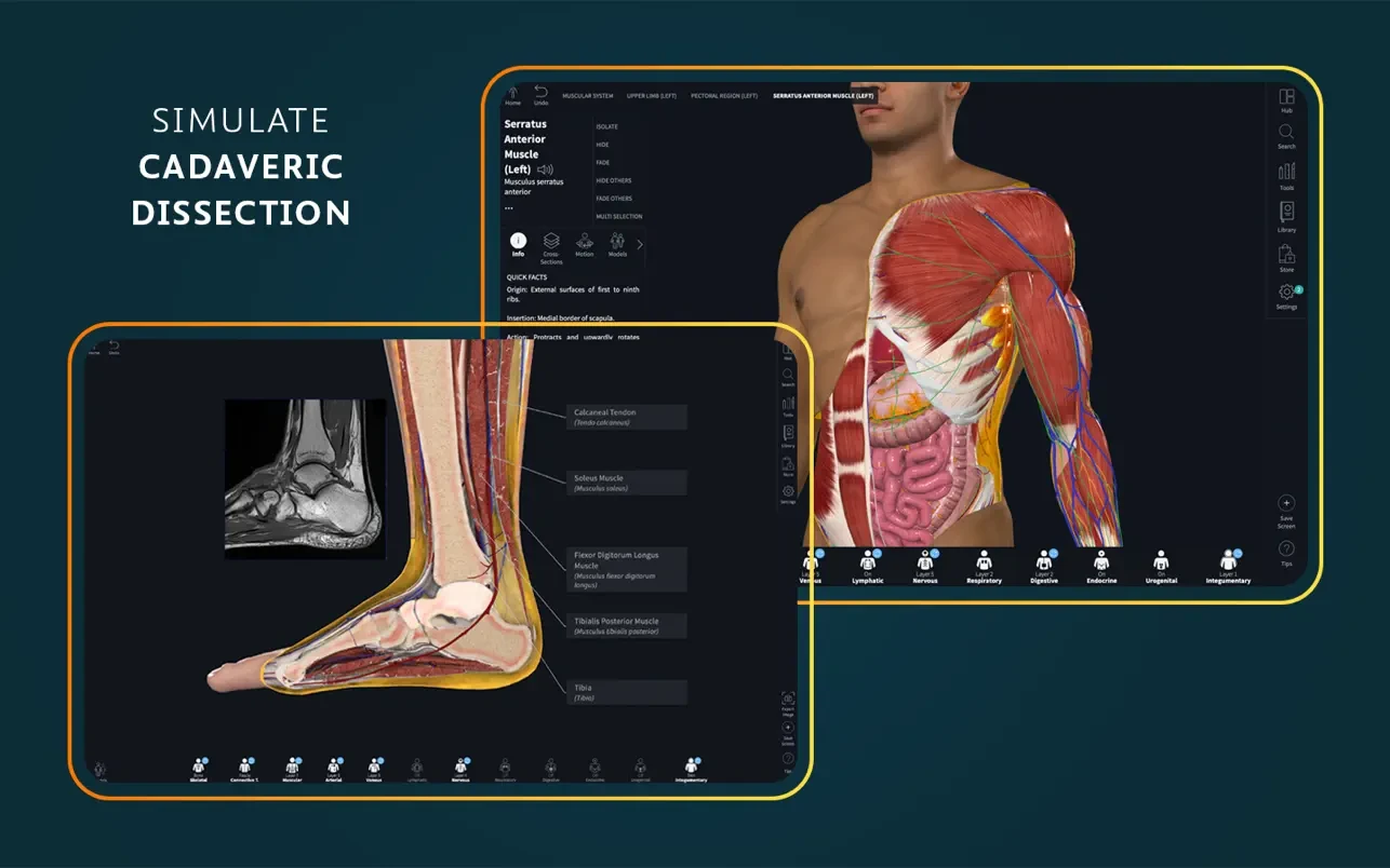 Complete Anatomy 截图 2