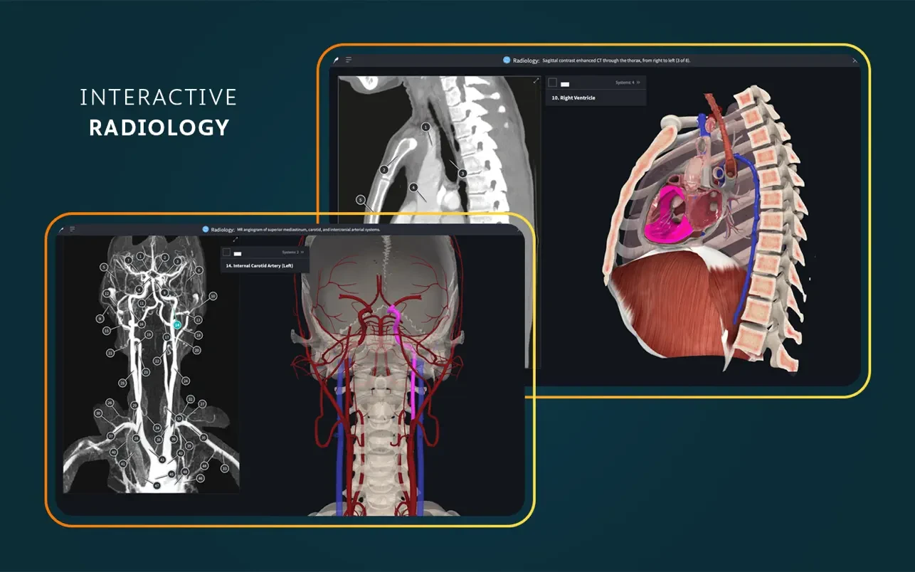 Complete Anatomy 截图 7